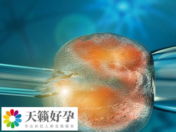 天籟好孕無麻取卵有無痛感