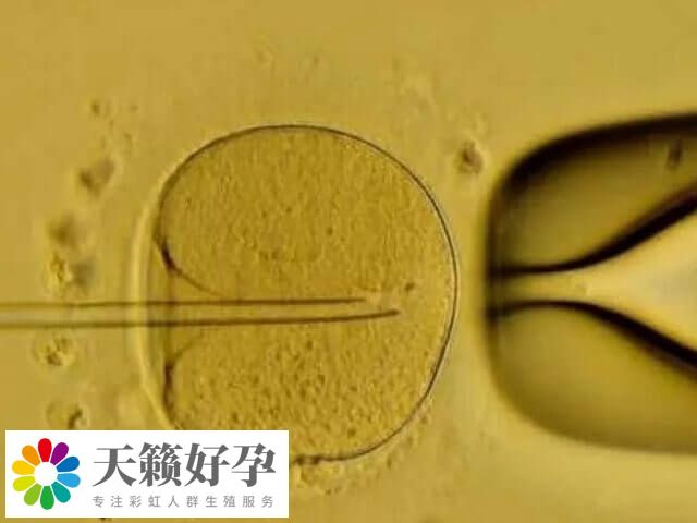 試管30天未見胎心胎芽怎么回事