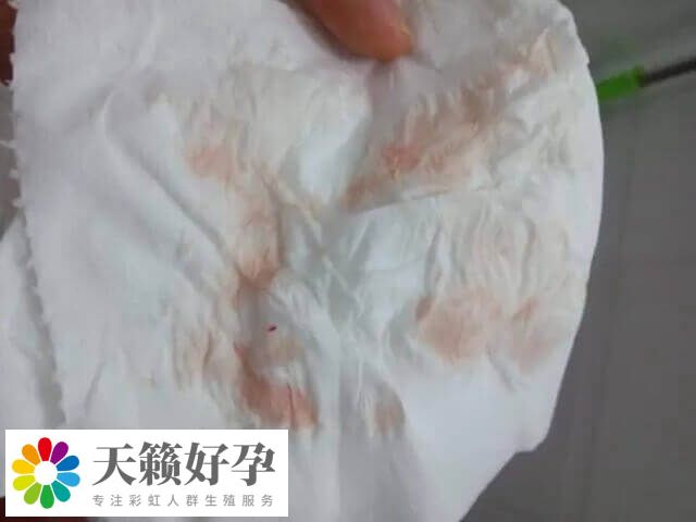 囊胚移植出褐色血能不能保胎