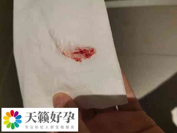 試管移植后肚子疼出血是不是失敗了