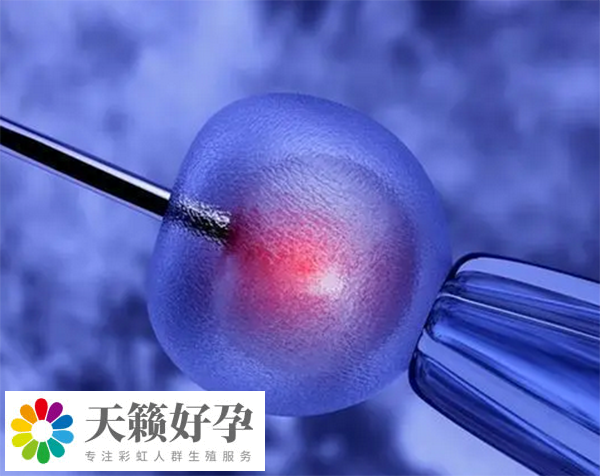 夫妻做人授失敗后做試管是否要實施手術