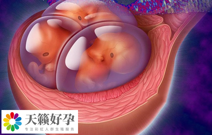 植入多個胚胎可能會導致多胎妊娠