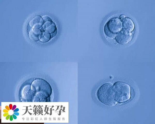 養(yǎng)囊可以提高試管移植成功率