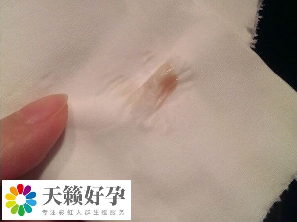 試管移植后胸脹疼可能是懷孕了