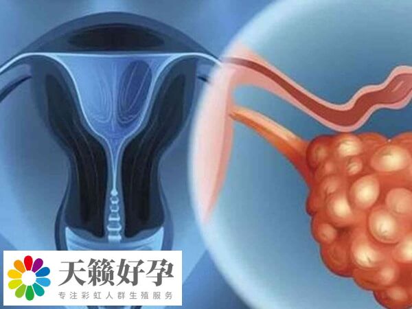 取卵后肚子痛可能是感染