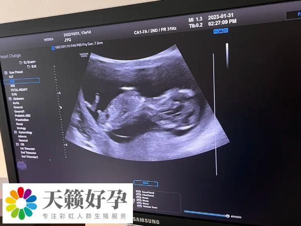 凍囊胚什么時(shí)候移植好看情況，具體得看月經(jīng)是否正常