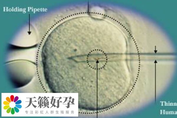 融合胚胎是一種胚胎發育的階段