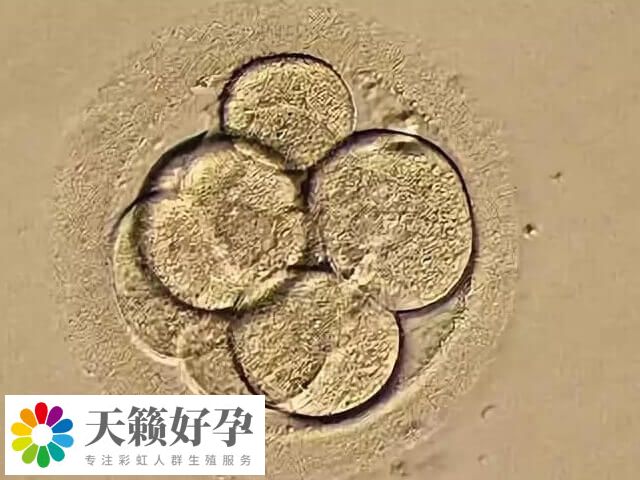 如何改善一卵多精的情況